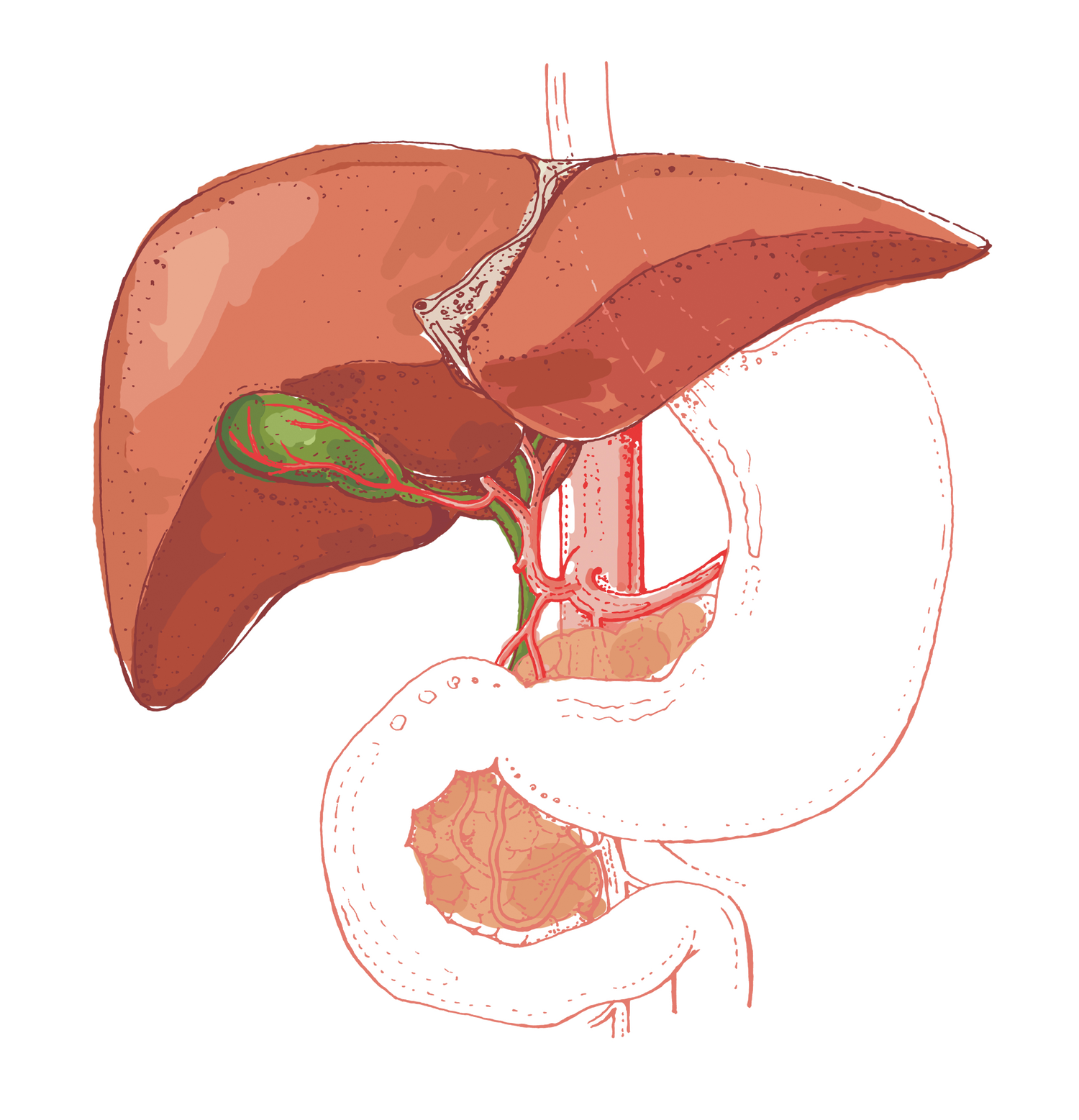 Nichole's Gallbladder Journey